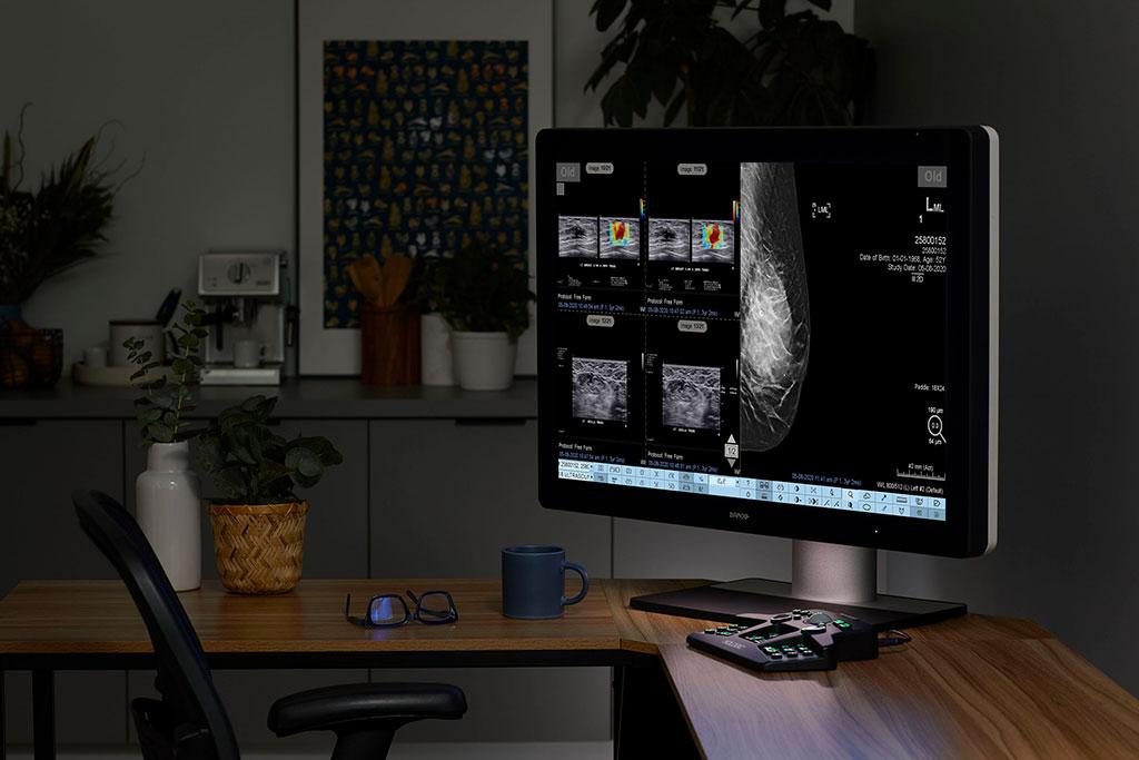 Monitor displaying x-rays on desk in office setting.